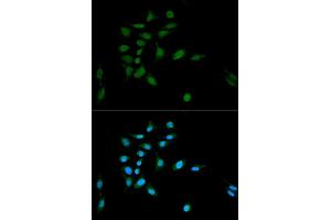 Immunofluorescence analysis of U2OS cells using PSMA1 antibody (ABIN5971354) at dilution of 1/100. (PSMA1 Antikörper)