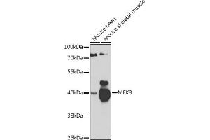Western blot analysis of extracts of various cell lines, using MEK3 antibody (ABIN6130544, ABIN6143484, ABIN6143485 and ABIN6223650) at 1:1000 dilution. (MAP2K3 Antikörper  (AA 1-170))