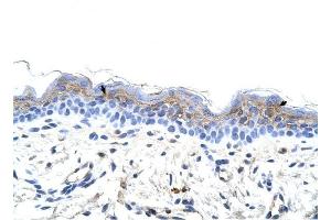 IRX3 antibody was used for immunohistochemistry at a concentration of 4-8 ug/ml to stain Squamous epithelial cells (arrows) in Human Skin. (IRX3 Antikörper  (C-Term))