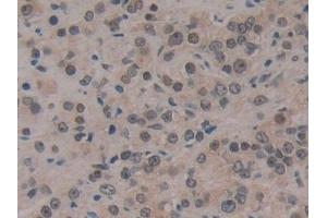 Immunohistochemistry (IHC) image for anti-Cold Inducible RNA Binding Protein (CIRBP) (AA 1-172) antibody (ABIN7442150)