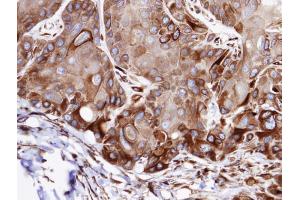 IHC-P Image Immunohistochemical analysis of paraffin-embedded SCC15 xenograft, using VPS16, antibody at 1:100 dilution. (VPS16 Antikörper  (C-Term))
