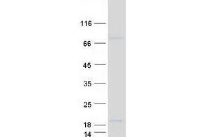 Validation with Western Blot (SMIM19 Protein (Transcript Variant 3) (Myc-DYKDDDDK Tag))