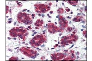 Immunohistochemistry (IHC) image for anti-Folate Hydrolase (Prostate-Specific Membrane Antigen) 1 (FOLH1) (AA 117-351) antibody (ABIN317554) (PSMA Antikörper  (AA 117-351))