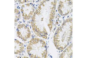 Immunohistochemistry of paraffin-embedded human stomach using IL13 antibody (ABIN3022881, ABIN3022882, ABIN3022883 and ABIN6219278) (40x lens). (IL-13 Antikörper  (AA 25-146))
