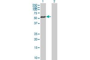 Western Blot analysis of AKT1 expression in transfected 293T cell line by AKT1 MaxPab polyclonal antibody. (AKT1 Antikörper  (AA 1-480))