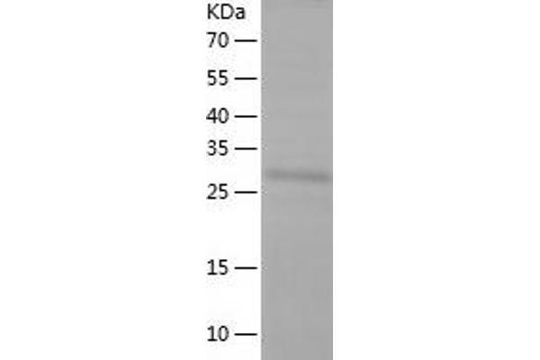 NSP5 Protein (AA 458-761) (His tag)