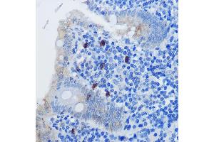 Immunohistochemistry of paraffin-embedded human appendix using IL8 Rabbit pAb (ABIN3016225, ABIN3016226, ABIN3016227 and ABIN6219634) at dilution of 1:100 (40x lens). (IL-8 Antikörper  (AA 21-99))