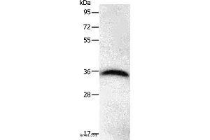 Western blot analysis of Hela cell, using PPP1CB Polyclonal Antibody at dilution of 1:450 (PPP1CB Antikörper)