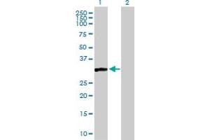 Western Blot analysis of CAPZA3 expression in transfected 293T cell line by CAPZA3 MaxPab polyclonal antibody. (CAPZA3 Antikörper  (AA 1-299))