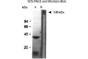 Western Blotting (WB) image for anti-Aggregation Factor antibody (ABIN191910) (Aggregation Factor Antikörper)