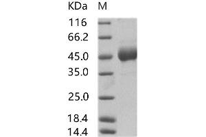 Western Blotting (WB) image for Sudan Ebola Virus Envelope Glycoprotein (SEBOV GP) protein (His tag,Mucin Tag) (ABIN7198918) (SEBOV GP Protein (His tag,Mucin Tag))