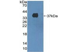 Detection of Recombinant HGFR, Human using Polyclonal Antibody to C-Met (MET) (c-MET Antikörper  (AA 1092-1379))