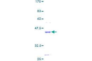 CST9L Protein (AA 1-147) (GST tag)