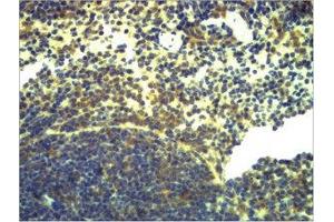 Immunohistochemical analysis of paraffin-embedded Mouse Spleen Tissue using TLR2 Polyclonal Antibody. (TLR2 Antikörper)