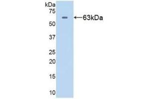 Detection of Recombinant HSPD1, Human using Polyclonal Antibody to Heat Shock Protein 60 (Hsp60) (HSPD1 Antikörper  (AA 1-573))
