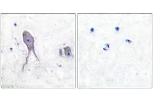 Immunohistochemistry analysis of paraffin-embedded human brain tissue, using Notch 2 (Cleaved-Asp1733) Antibody. (NOTCH2 Antikörper  (Cleaved-Asp1733))