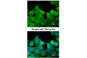 ICC/IF Image Immunofluorescence analysis of paraformaldehyde-fixed A431, using EXOC7, antibody at 1:200 dilution. (EXOC7 Antikörper)