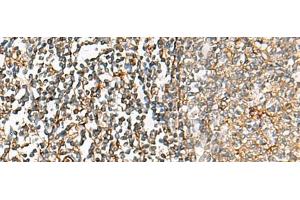 Immunohistochemistry of paraffin-embedded Human tonsil tissue using CHKA Polyclonal Antibody at dilution of 1:35(x200) (Choline Kinase alpha Antikörper)