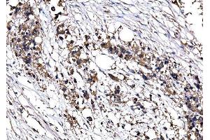 IHC analysis of IMPDH1 using anti-IMPDH1 antibody (ABIN7599864). (IMPDH1 Antikörper  (AA 123-500))