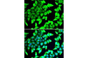 Immunofluorescence analysis of A549 cells using HDAC5 antibody. (HDAC5 Antikörper)