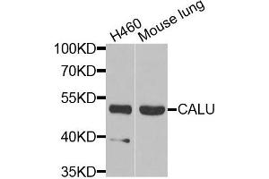 Western blot analysis of extracts of H460 and mouse lung cells, using CALU antibody. (CALU Antikörper)