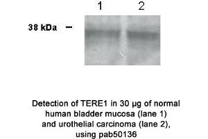 Image no. 1 for anti-UbiA Prenyltransferase Domain Containing 1 (UBIAD1) (N-Term) antibody (ABIN363445) (UBIAD1 Antikörper  (N-Term))