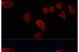 Immunofluorescence analysis of HeLa cells using CA9 Polyclonal Antibody at dilution of 1:100. (CA9 Antikörper)