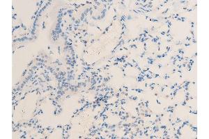 Immunohistochemistry (IHC) image for anti-Microphthalmia-Associated Transcription Factor (MITF) (pSer180), (pSer73) antibody (ABIN6255037)
