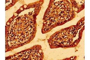 Immunohistochemistry of paraffin-embedded human small intestine tissue using ABIN7146314 at dilution of 1:100 (MCU Antikörper  (AA 155-233))
