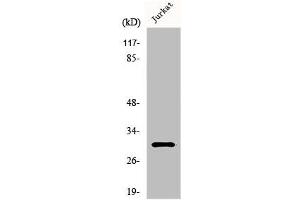 Western Blot analysis of K562 cells using HoxD12 Polyclonal Antibody (HOXD12 Antikörper  (C-Term))