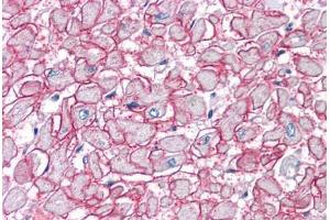Human Heart: Formalin-Fixed, Paraffin-Embedded (FFPE) (SGCB Antikörper  (AA 87-197))