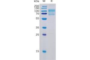Human B7-1 Protein, mFc-His Tag on SDS-PAGE under reducing condition. (CD80 Protein (CD80) (mFc-His Tag))