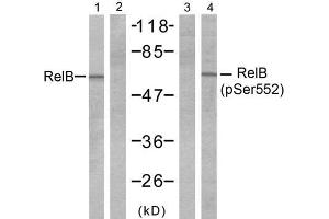 Western blot analysis of extracts from A431 cells, untreated or treated with EGF (200ng/ml 10min), using RelB (Ab-552) antibody (E021247, Line 1 and 2) and RelB (phospho-Ser552) antibody (E011255, Line 3 and 4). (RELB Antikörper)