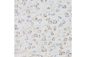 Immunohistochemistry of paraffin-embedded mouse brain using MIP antibody (ABIN5971491) at dilution of 1/100 (40x lens). (MIP Antikörper)