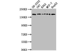 Western Blot Positive WB detected in: SH-SY5Y whole cell lysate, U87 whole cell lysate, K562 whole cell lysate, MCF-7 whole cell lysatee, HepG2 whole cell lysate All lanes: INSRR antibody at 1:2000 Secondary Goat polyclonal to rabbit IgG at 1/50000 dilution Predicted band size: 144 kDa Observed band size: 144 kDa (INSRR Antikörper  (AA 747-921))