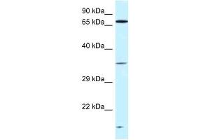 Western Blot showing VPS26A antibody used at a concentration of 1 ug/ml against Fetal Kidney Lysate