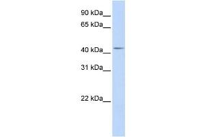 Western Blotting (WB) image for anti-DENN/MADD Domain Containing 1B (DENND1B) antibody (ABIN2459576) (DENND1B Antikörper)