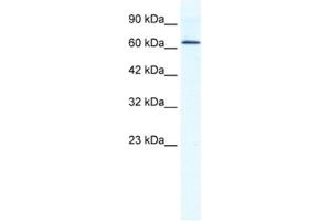 Western Blotting (WB) image for anti-DEAD (Asp-Glu-Ala-Asp) Box Polypeptide 21 (DDX21) antibody (ABIN2461344)