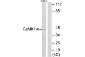 Western Blotting (WB) image for anti-Calcium/calmodulin-Dependent Protein Kinase I (CAMK1) (AA 143-192) antibody (ABIN2888788) (CAMK1 Antikörper  (AA 143-192))