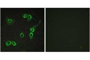 Immunofluorescence analysis of COS7 cells, using C3AR1 Antibody. (C3AR1 Antikörper  (AA 175-224))