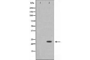 Western blot analysis on 293 cell lysate using Bak Antibody,The lane on the left is treated with the antigen-specific peptide. (BAK1 Antikörper  (N-Term))