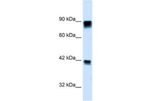 Western Blotting (WB) image for anti-Retinoblastoma 1 (RB1) antibody (ABIN2460672) (Retinoblastoma 1 Antikörper)