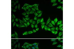 Immunofluorescence analysis of U2OS cells using TPMT Polyclonal Antibody (TPMT Antikörper)
