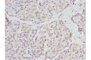 Immunohistochemistry of paraffin-embedded human pancreatic tissue using ABIN7168685 at dilution of 1:100 (FRZB Antikörper  (AA 166-325))