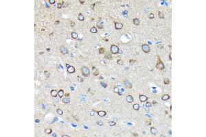 Immunohistochemistry of paraffin-embedded rat brain using Huntingtin Rabbit mAb (ABIN7267793) at dilution of 1:100 (40x lens). (Huntingtin Antikörper)