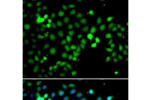 Immunofluorescence analysis of A549 cells using MTF2 Polyclonal Antibody (MTF2 Antikörper)