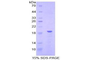 SDS-PAGE (SDS) image for Relaxin (AA 25-181) protein (His tag) (ABIN1878279)