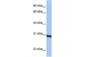 WB Suggested Anti-C20orf195 Antibody Titration: 0. (C20orf195 Antikörper  (N-Term))