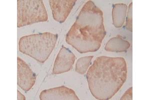Used in DAB staining on fromalin fixed paraffin- embedded skeletal muscle tissue (NT5M Antikörper  (AA 30-209))