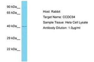 Image no. 1 for anti-Coiled-Coil Domain Containing 94 (CCDC94) (AA 239-288) antibody (ABIN6750639) (CCDC94 Antikörper  (AA 239-288))